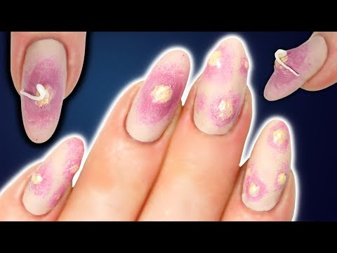 DIY HALLOWEEN EXPLODING PIMPLE NAILS | SQUEEZE SPOT NAIL ART | REALISTIC SFX CYST NAILART