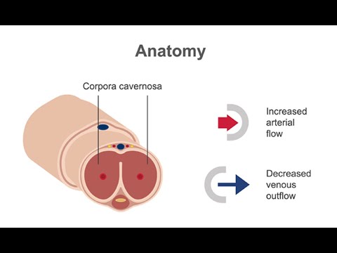 Diagnosing priapism