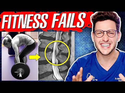 Worst Fitness Mistakes My Patients Make