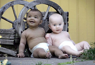 10 Extraordinary Tales of Extraordinary Twins - 19