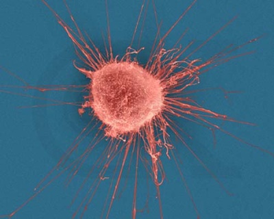 Cancer Cell, Breast.Jpg