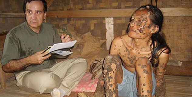 Another 10 Bizarre Medical Tales - Vimarsana News