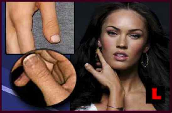 10 Celebrities with Strange Physical Flaws - 3