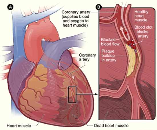 Heart Coronary Artery