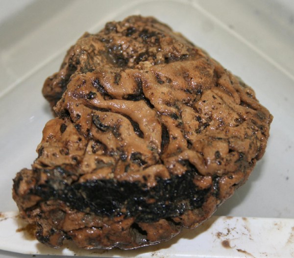 2,600-year-old brain