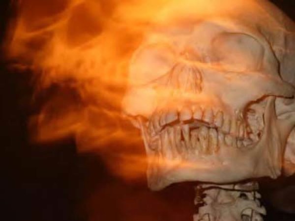 Burning-Skull