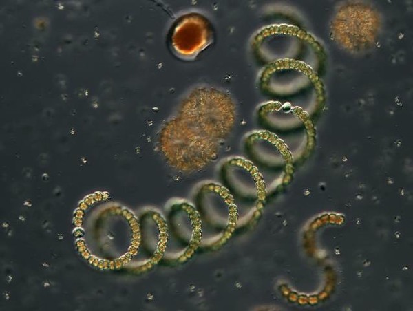 microorganisms in pond water under microscope