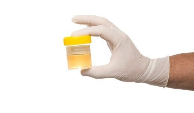 Drug-Test-Urine-Sample