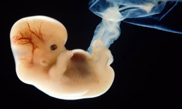 Embryo 6Wks