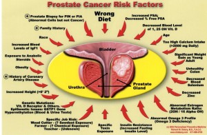Prostate-Cancer-Risk-Factors