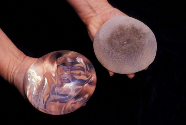 Saline Filled Silicon Breast Implants
