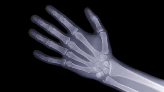 x-ray of open hand