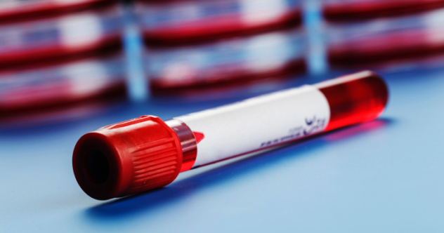 10 Strange Uses For Blood - Listverse - Vimarsana News