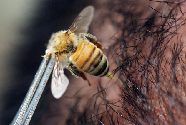 Bee Acupunture Practiced In Indonesia