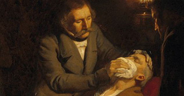 10 Incredibly Strange Surgical Stories - Vimarsana News