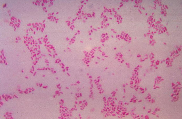 6-Bacteroides-Fragilis