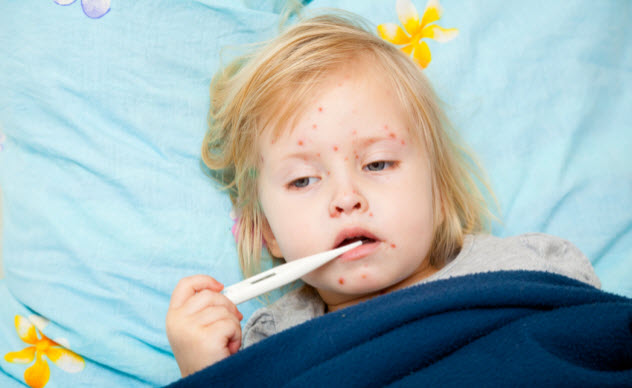 8-measles_000017381245_Small