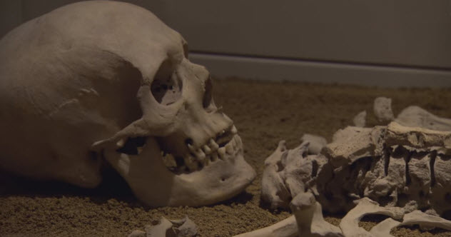 10 Horrifying Medical Cases That Make You Glad You Didn't Live In The Past - Vimarsana News