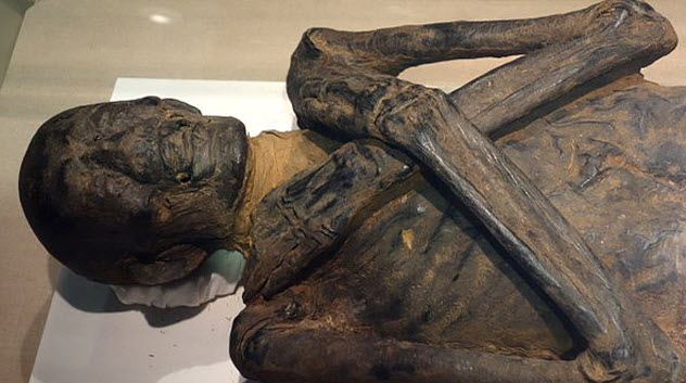 Top 10 Things You Never Knew About Corpse Medicine - 30