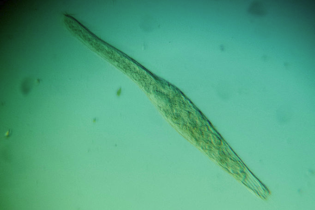 10 Freakishly Large Single-Celled Organisms - Listverse