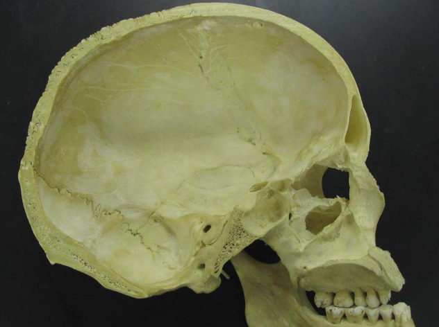 Human Skull Interior
