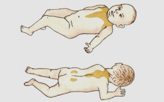 3a-newborn-brown-fat-areas