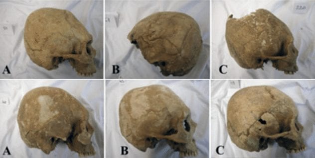 carpathian-basin-hun-skulls