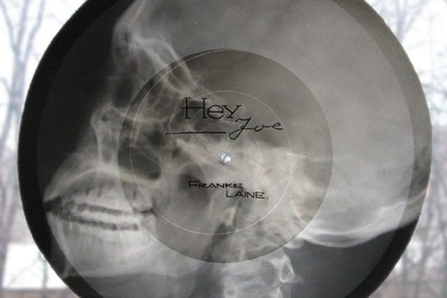 x-ray-record