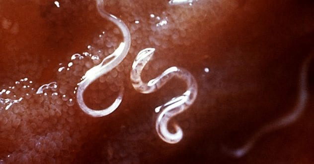 10 Weird Ways Disease Altered The World - Vimarsana News