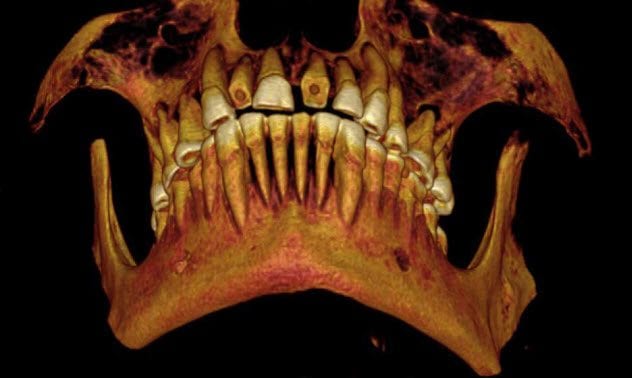 6-mummys-teeth-sinus-infection