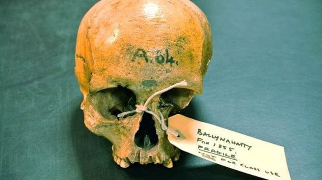 9-Ballynahatty-woman-skull