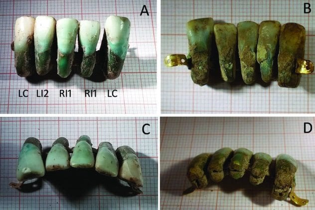 Oldest Dentures