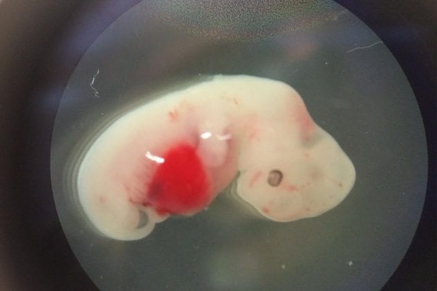 Pig-Human Embryo