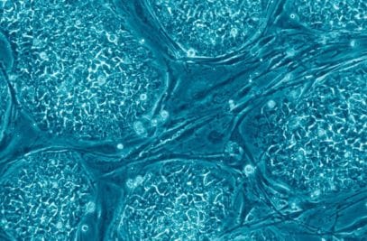 Top 10 Greatest Scientific Feats In The Past Decade - Listverse