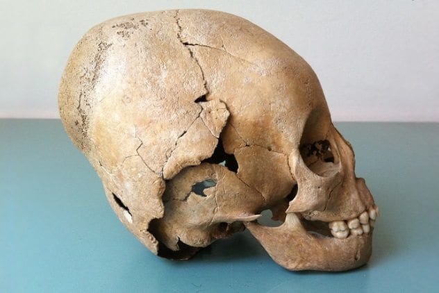 Elongated Roman Skull
