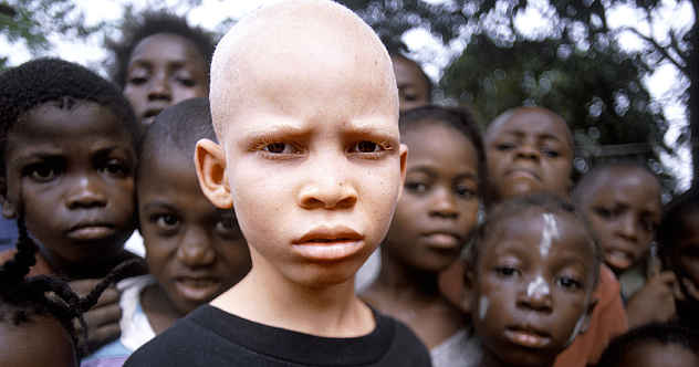 dravidian albino people