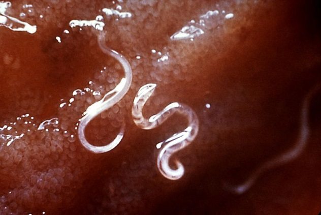 Top 10 Parasites That Could Be Infecting You Right Now - 6