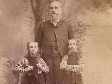 Top 10 Curious Humans Exhibited in P.T. Barnum's Circus - Listverse