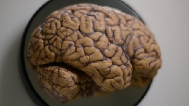 Le top 10 des traitements médicaux dégoûtants et inattendus 4-human-brain