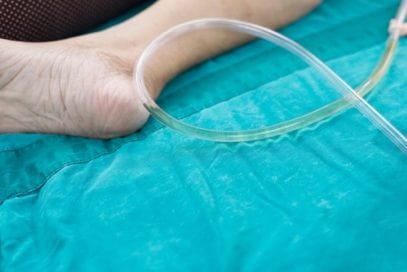 Top 10 Painful Facts And Calamities Involving Urinary Catheters - Listverse
