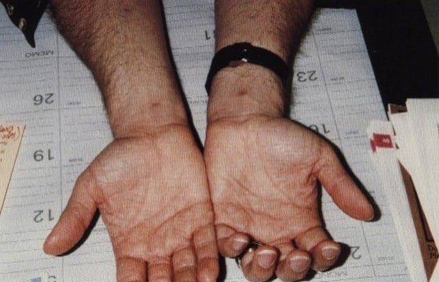 10 Infamous Cases Of Stigmata - 54