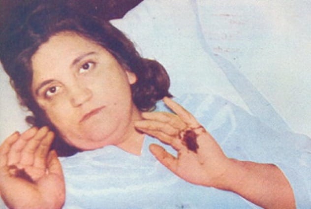 10 Infamous Cases Of Stigmata - 54