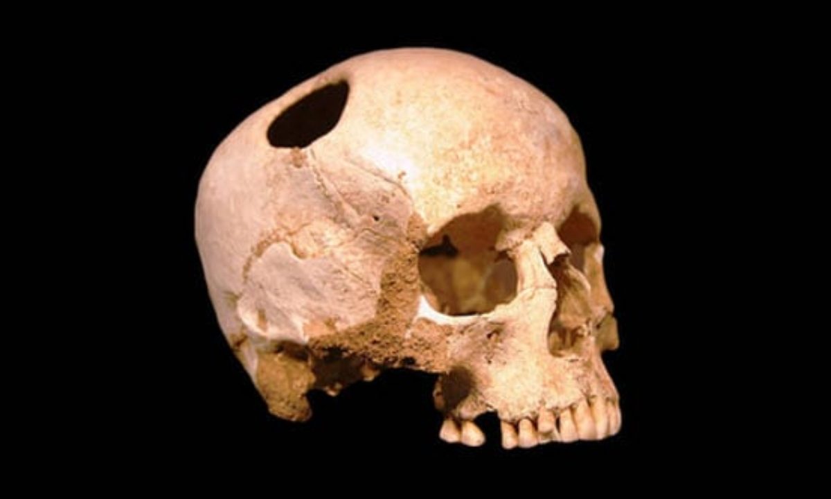 10 Weird Medieval Medical Practices That Actually Work