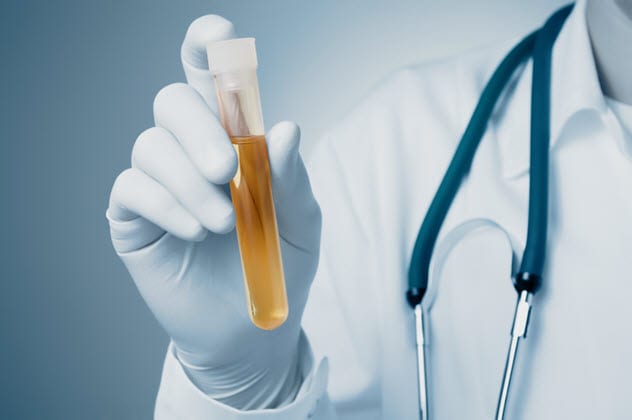 10 Unusual Urine Uses And Studies - 40