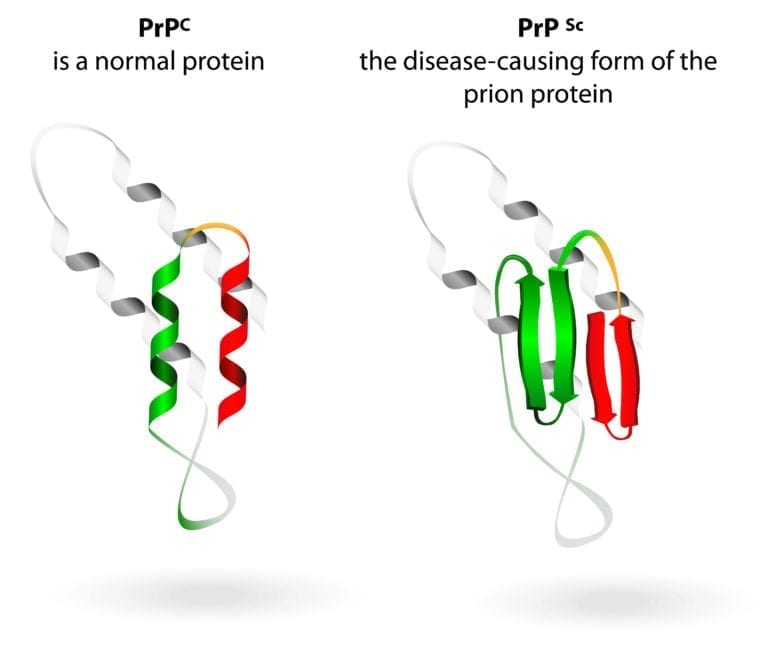 10 Frightening Facts About The Mysterious Deadly Prion Diseases - Listverse