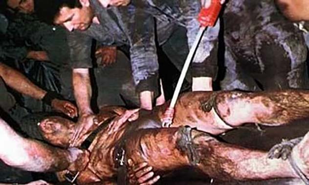 Bagram Torture