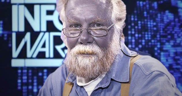 argyria paul karason