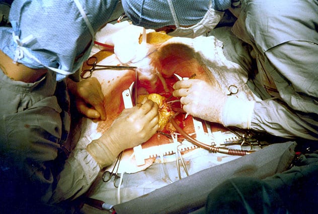 Top 10 Bloody Histories Behind Common Surgeries - 70