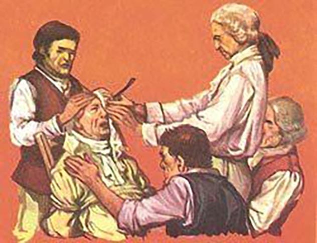 Top 10 Bloody Histories Behind Common Surgeries - 63