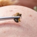 10 Medical Treatments Your Doctor Probably Won't Approve